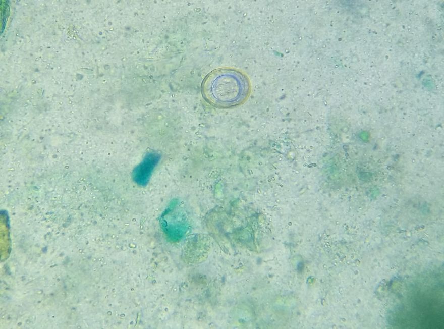 I Find Cosmos Under My Microscope And With Microbial Plate - Microsmos I Find Cosmos Under My Microscope And With Microbial Plate - Microsmos