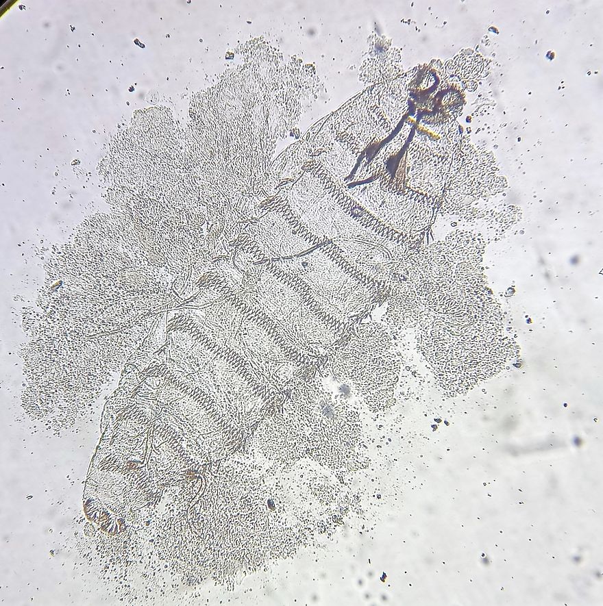 I Find Cosmos Under My Microscope And With Microbial Plate - Microsmos