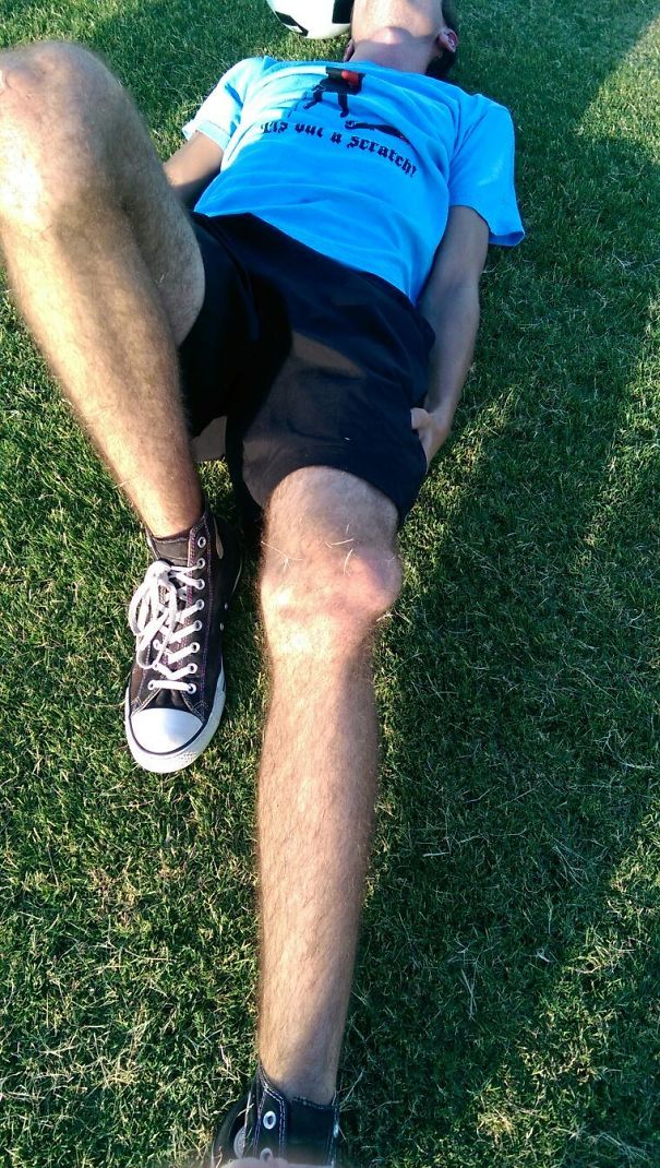 So My Friend Dislocated His Knee The Other Day. Look At The Shirt He Was Wearing When It Happened