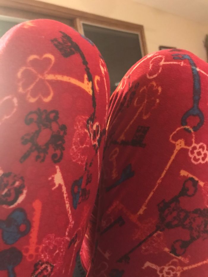 I Collect Knees So Far I Have Two Of Them!