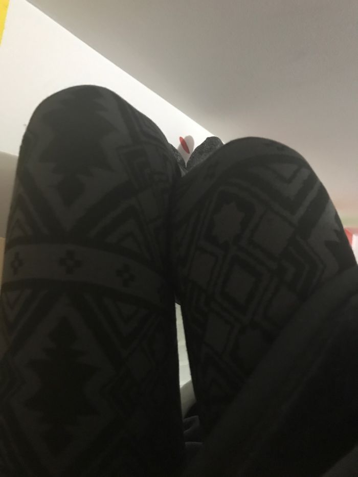 I Collect Knees So Far I Have Two!