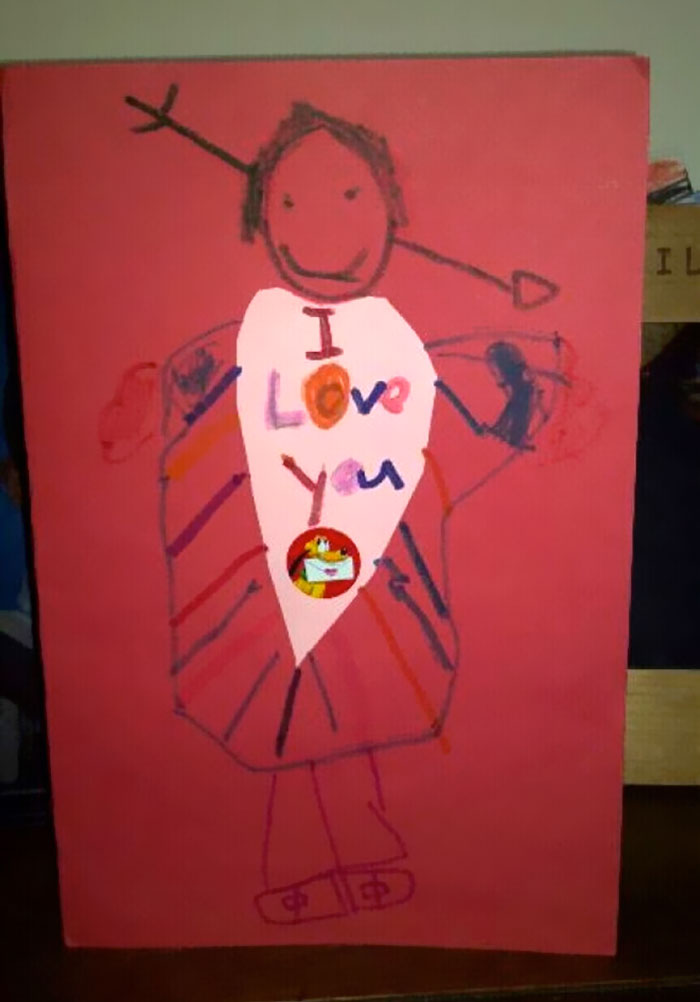 Cupid's Arrow Stuck In A Head Is Definitely Not A Big Deal