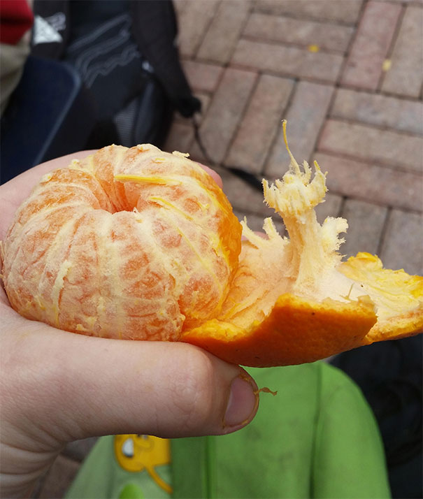 When The Whole Anus Comes Out