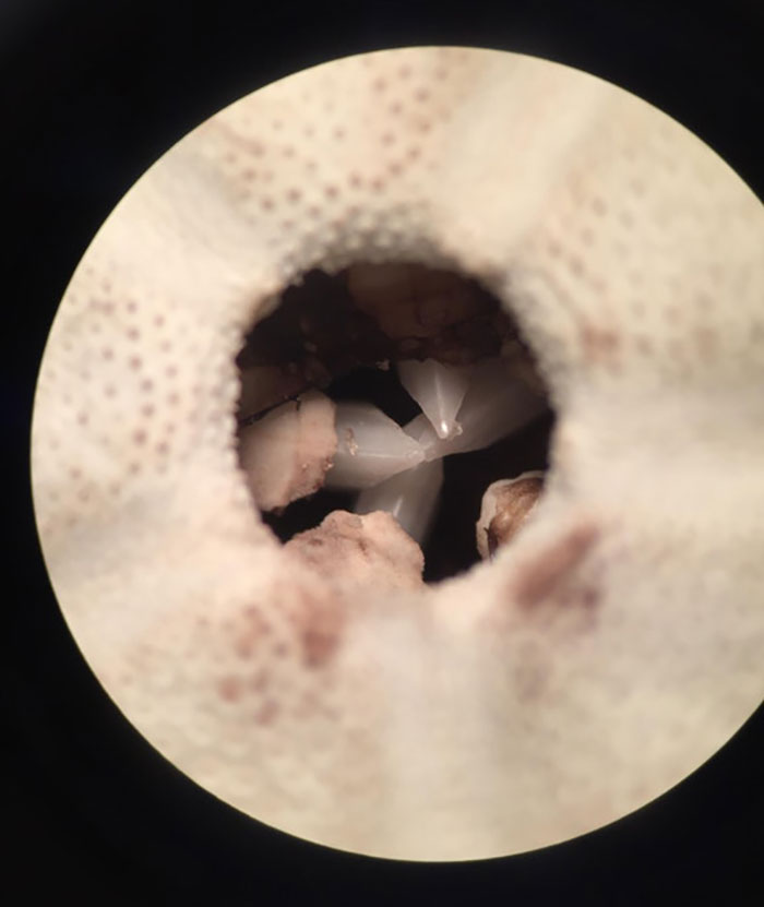 What A Sea Urchin's Mouth Looks Like