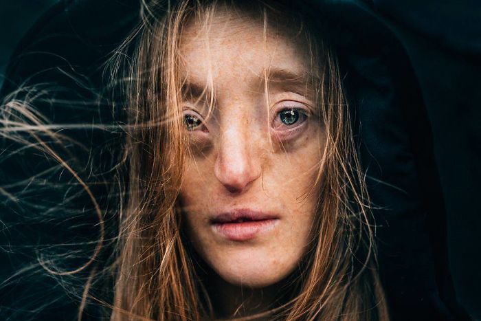 Model-Breaking-Beauty-Standards-Ilka-Bruhl