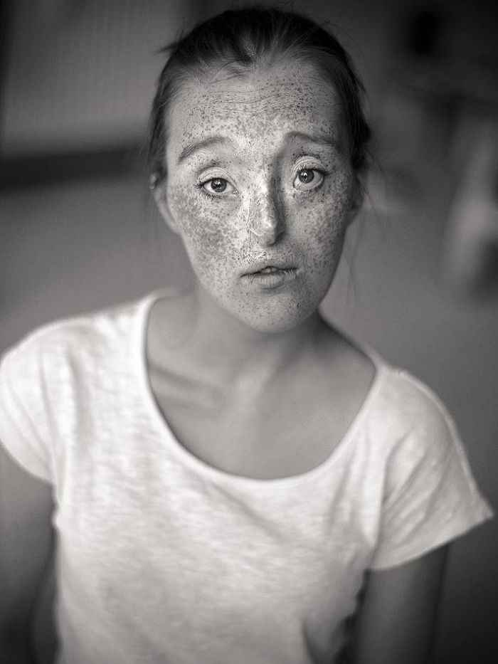 Model-Breaking-Beauty-Standards-Ilka-Bruhl