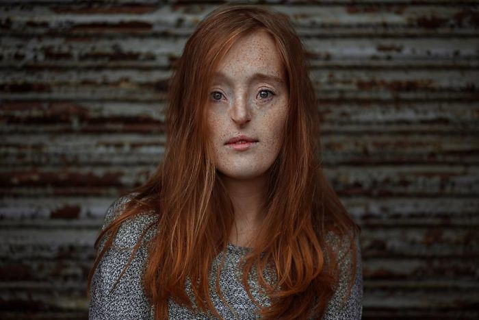 Model-Breaking-Beauty-Standards-Ilka-Bruhl