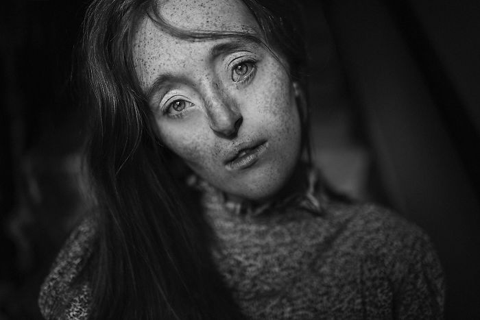 Model-Breaking-Beauty-Standards-Ilka-Bruhl