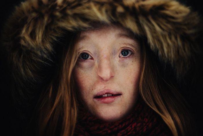 Model-Breaking-Beauty-Standards-Ilka-Bruhl