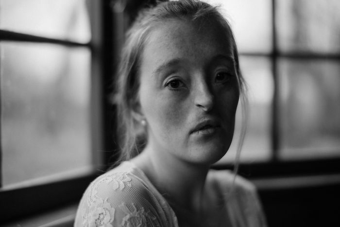 Model-Breaking-Beauty-Standards-Ilka-Bruhl