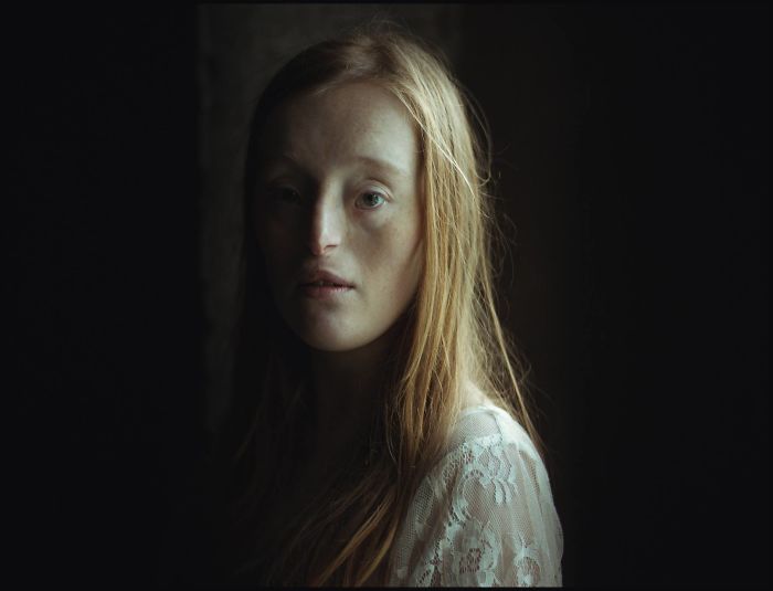 Model-Breaking-Beauty-Standards-Ilka-Bruhl