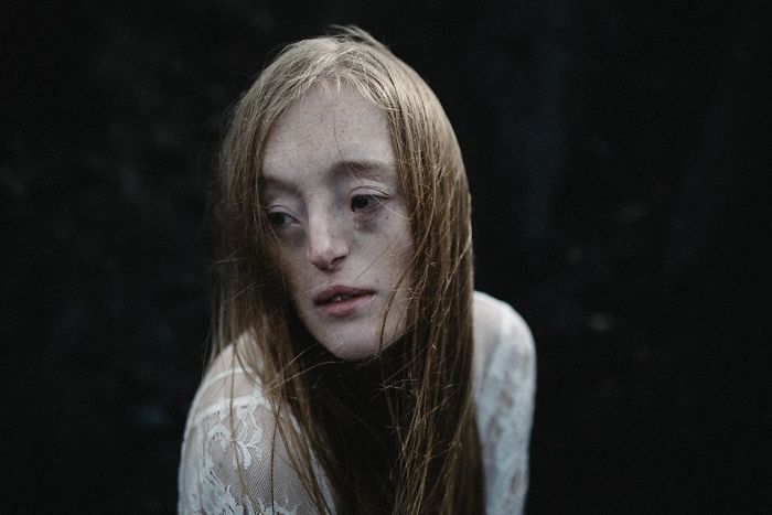 Model-Breaking-Beauty-Standards-Ilka-Bruhl