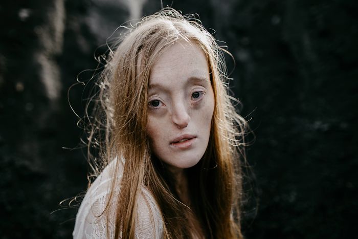 Model-Breaking-Beauty-Standards-Ilka-Bruhl