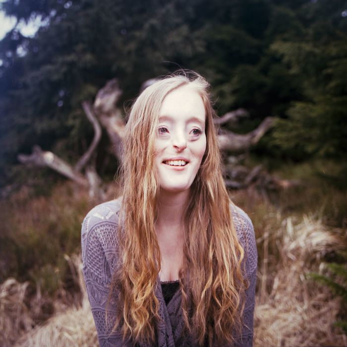 Model-Breaking-Beauty-Standards-Ilka-Bruhl