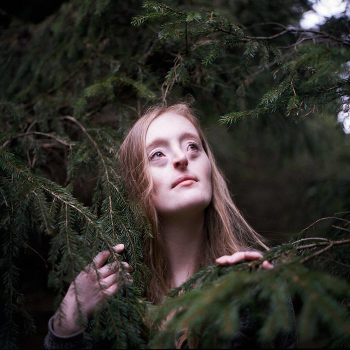 Model-Breaking-Beauty-Standards-Ilka-Bruhl