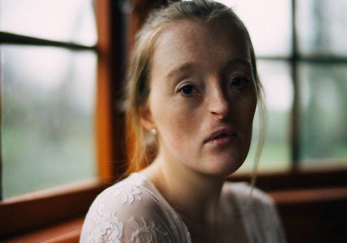 Model-Breaking-Beauty-Standards-Ilka-Bruhl