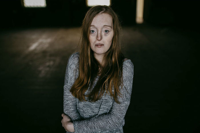 Model-Breaking-Beauty-Standards-Ilka-Bruhl