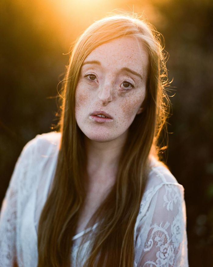 Model-Breaking-Beauty-Standards-Ilka-Bruhl