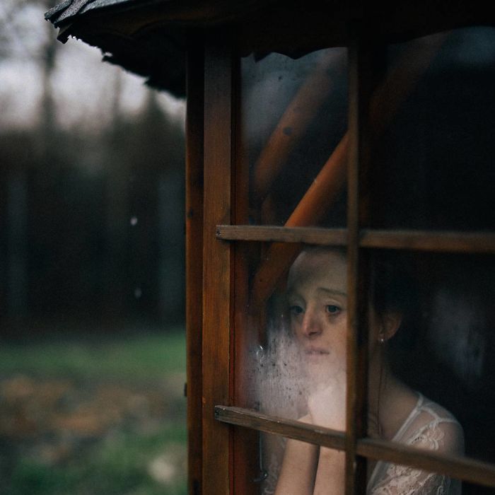 Model-Breaking-Beauty-Standards-Ilka-Bruhl