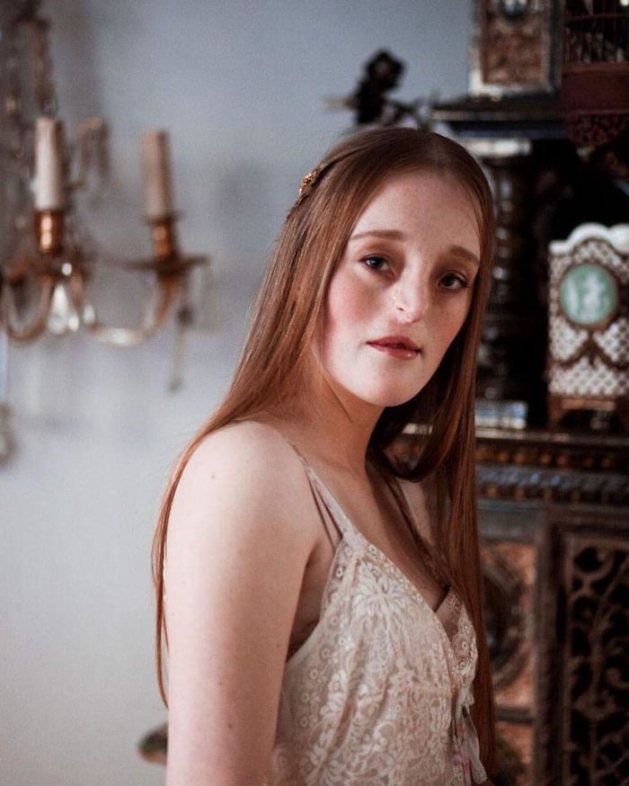 Model-Breaking-Beauty-Standards-Ilka-Bruhl