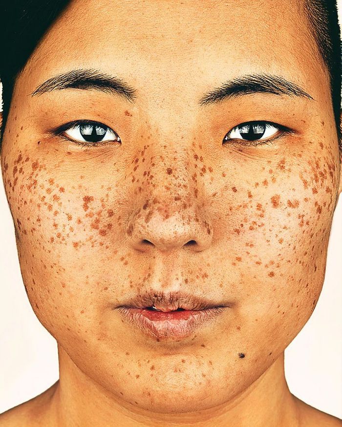 The Beauty Of The Freckles By The Photographer Brock Elbank