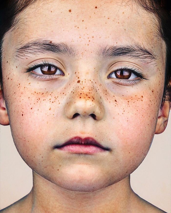 The Beauty Of The Freckles By The Photographer Brock Elbank