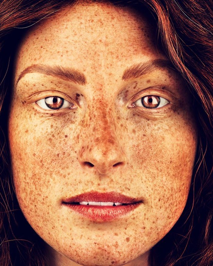 The Beauty Of The Freckles By The Photographer Brock Elbank