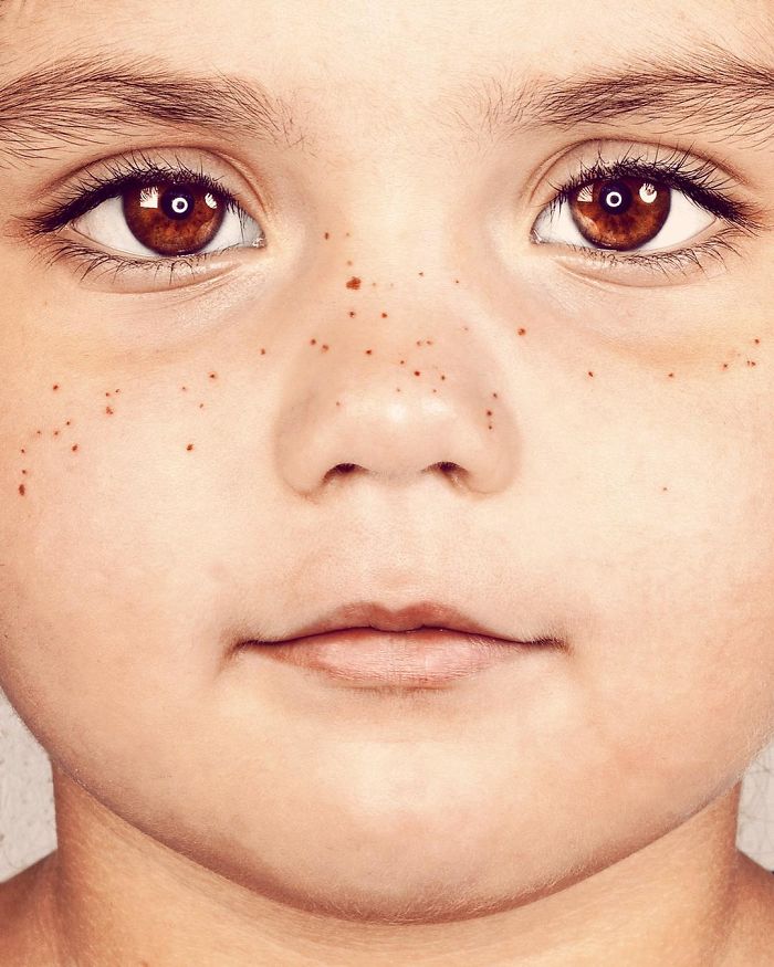 The Beauty Of The Freckles By The Photographer Brock Elbank