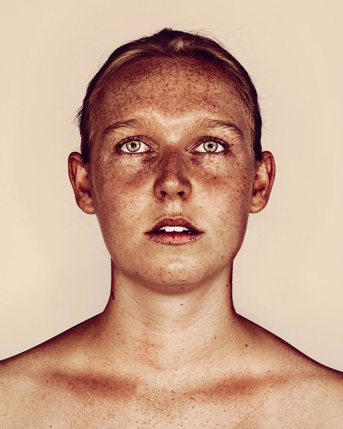 The Beauty Of The Freckles By The Photographer Brock Elbank