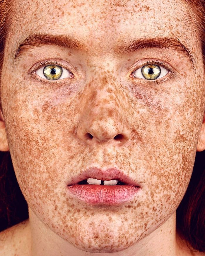 The Beauty Of The Freckles By The Photographer Brock Elbank