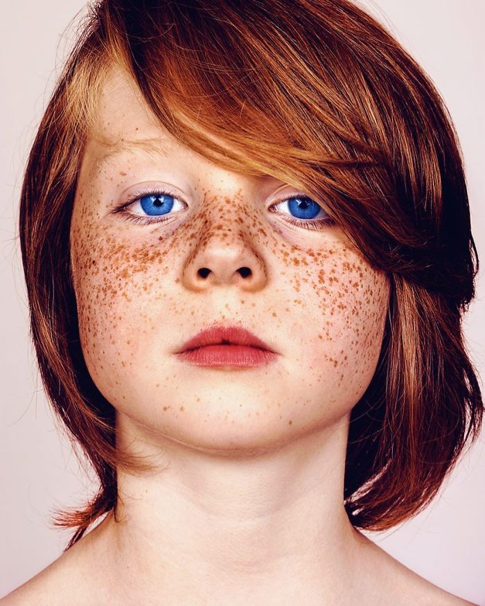 The Beauty Of The Freckles By The Photographer Brock Elbank