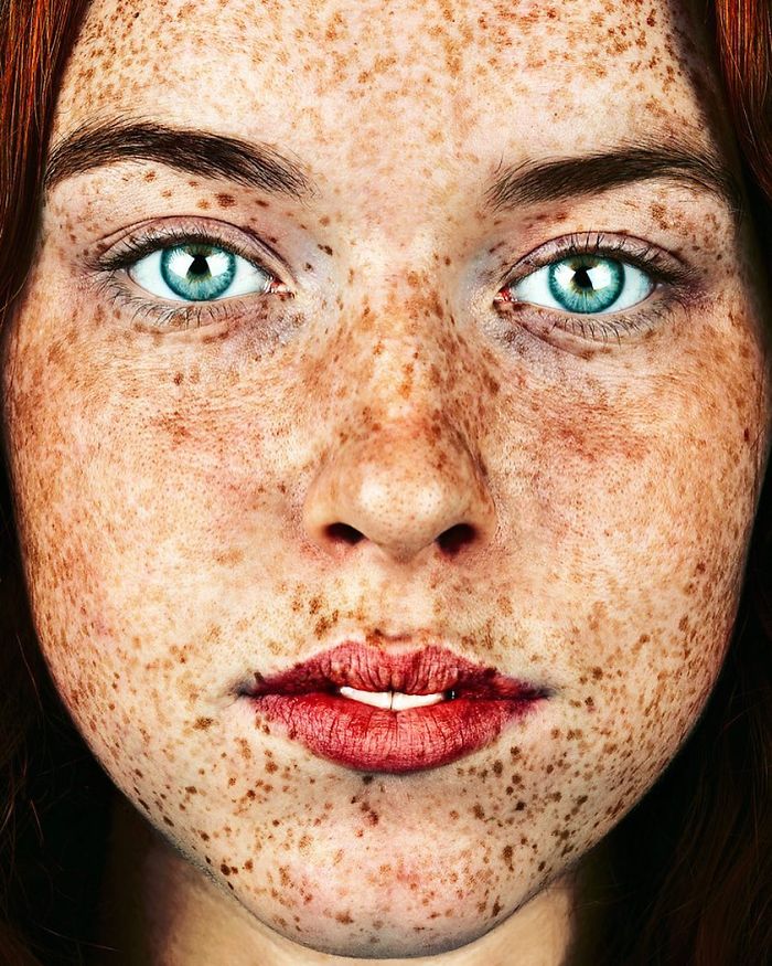 The Beauty Of The Freckles By The Photographer Brock Elbank
