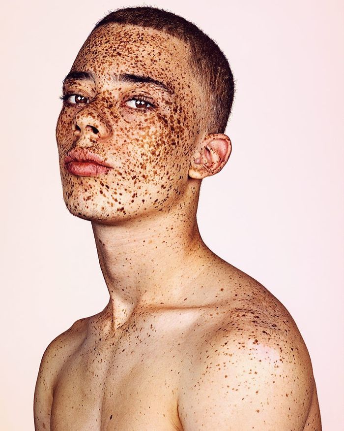 The Beauty Of The Freckles By The Photographer Brock Elbank