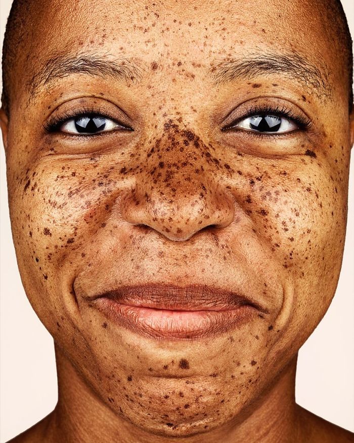 The Beauty Of The Freckles By The Photographer Brock Elbank
