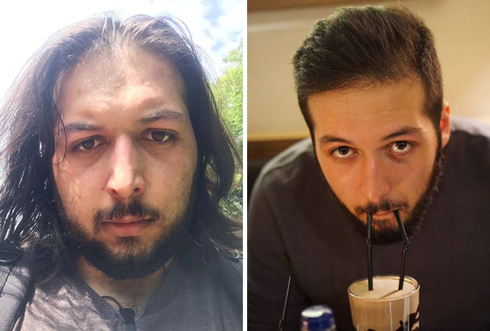 I Didn’t Do Anything Special, But I’m Not Ugly Anymore