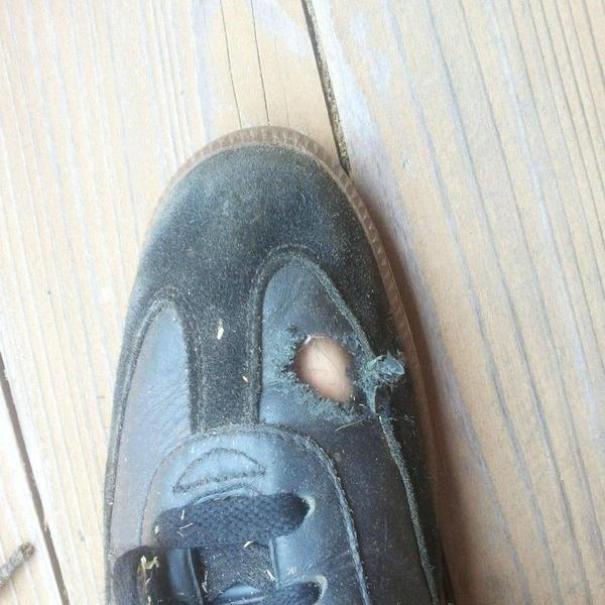 Close Call With A Chain Saw