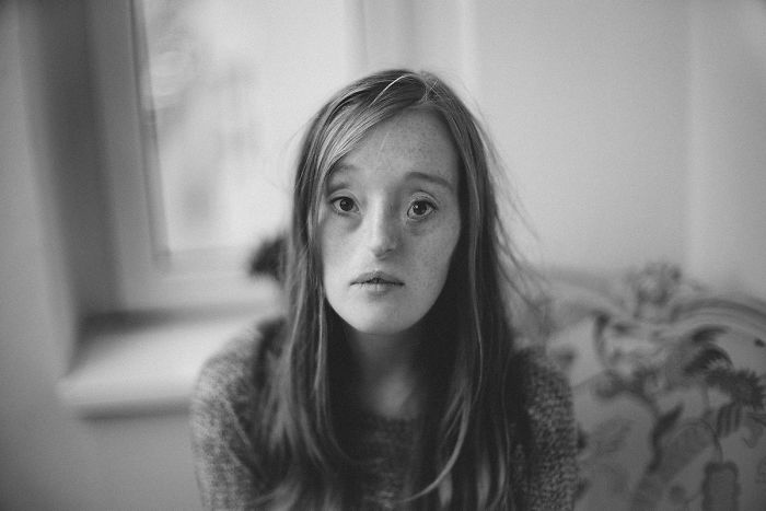 Model-Breaking-Beauty-Standards-Ilka-Bruhl