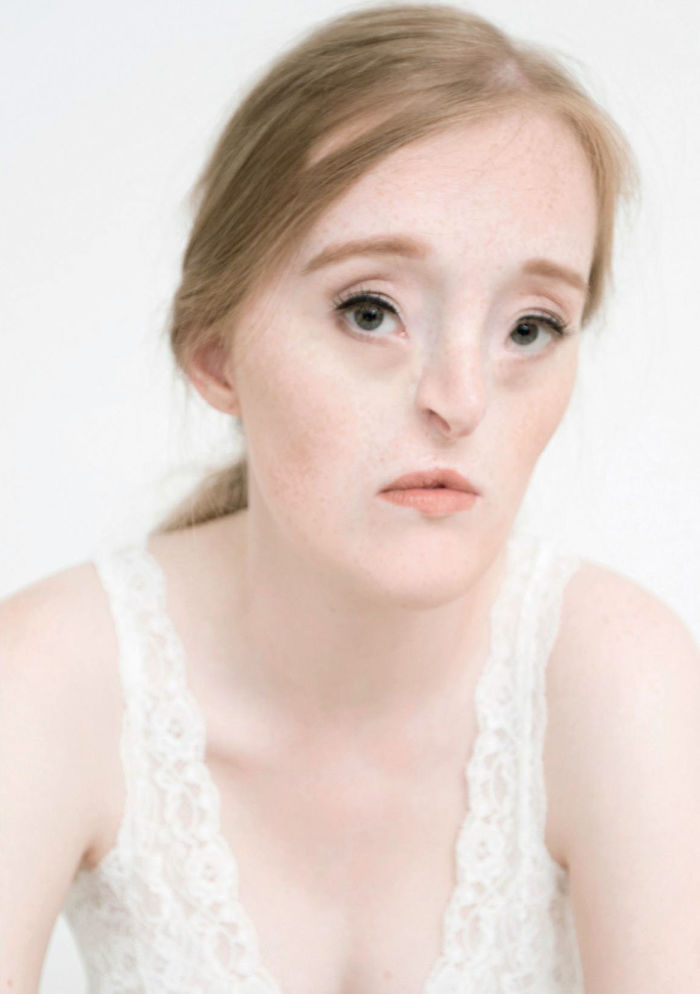 Model-Breaking-Beauty-Standards-Ilka-Bruhl