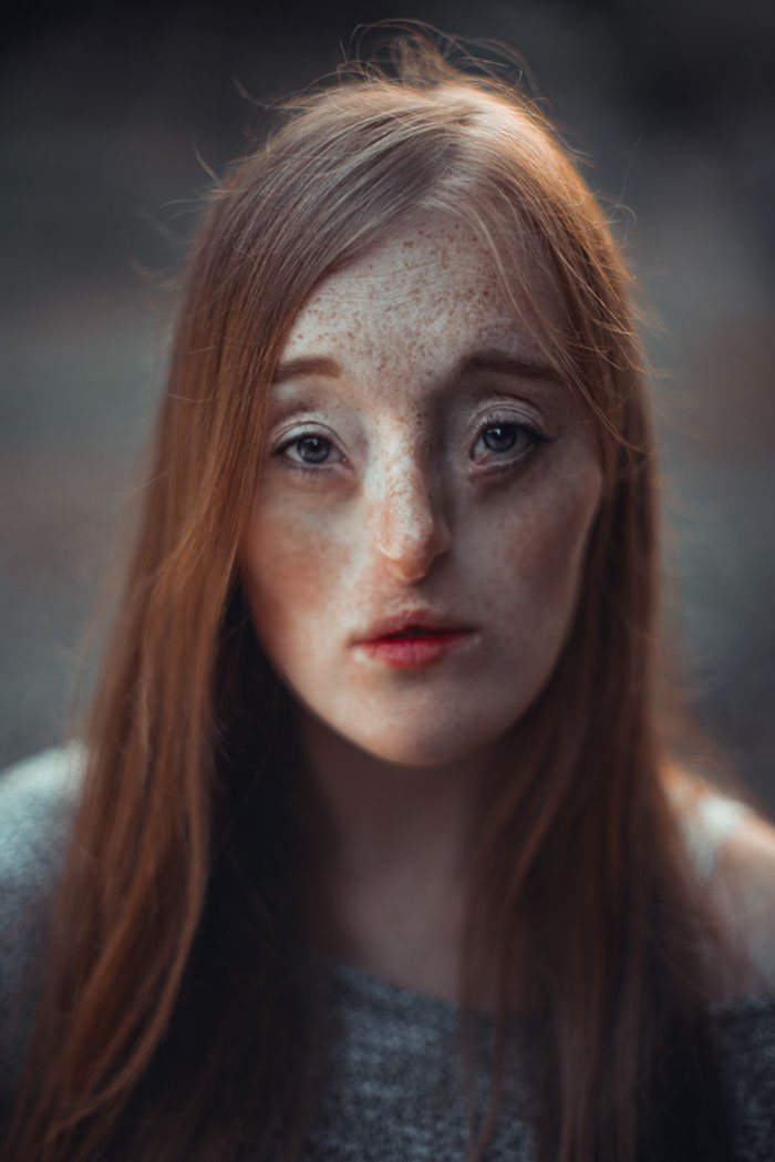 Model-Breaking-Beauty-Standards-Ilka-Bruhl