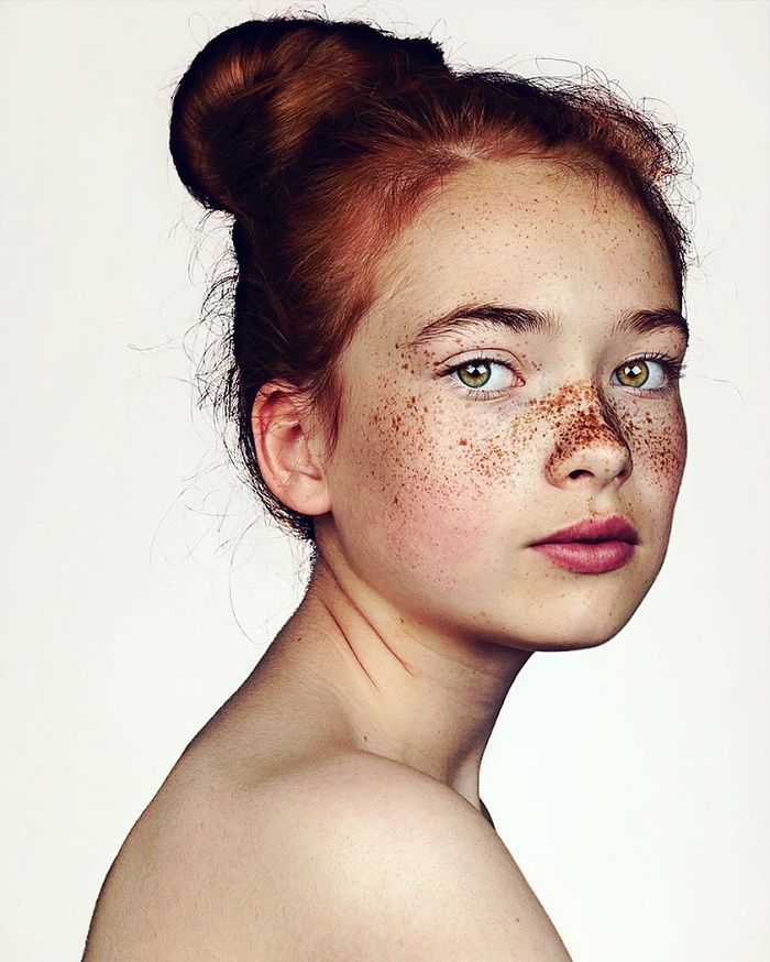 The Beauty Of The Freckles By The Photographer Brock Elbank