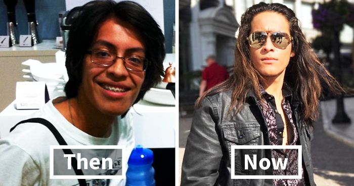 People Who Used To Be “Ugly Ducklings” Share Their Transformations, And We Can Barely Recognize Them (New Pics)