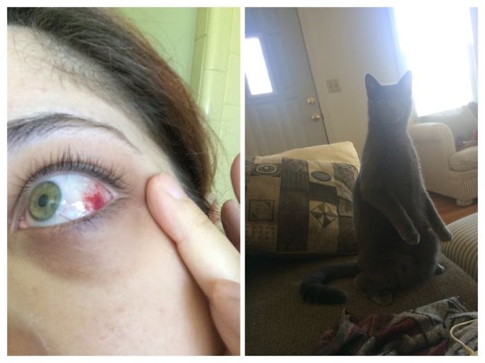 My Son Is A Dumbass And Likes To Jump Straight At Faces... Claws Out.