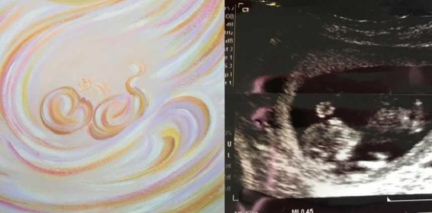 Lawyer Mom Gives Up Career To Pursue Her Real Passion, Ultrasound Painting Lawyer Mom Gives Up Career To Pursue Her Real Passion, Ultrasound Painting