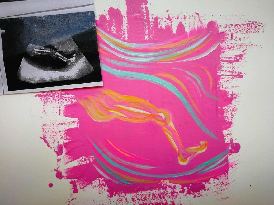 Lawyer Mom Gives Up Career To Pursue Her Real Passion, Ultrasound Painting Lawyer Mom Gives Up Career To Pursue Her Real Passion, Ultrasound Painting