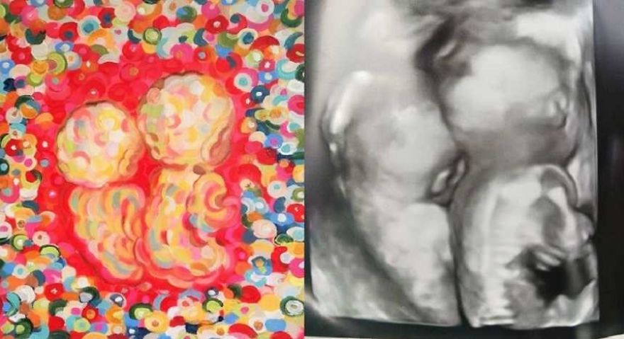Lawyer Mom Gives Up Career To Pursue Her Real Passion, Ultrasound Painting Lawyer Mom Gives Up Career To Pursue Her Real Passion, Ultrasound Painting