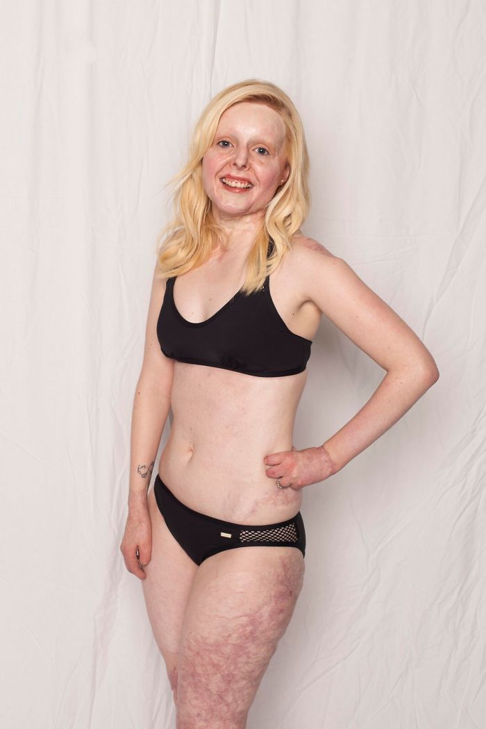 Love Disfigure Swimwear Photo Campaign