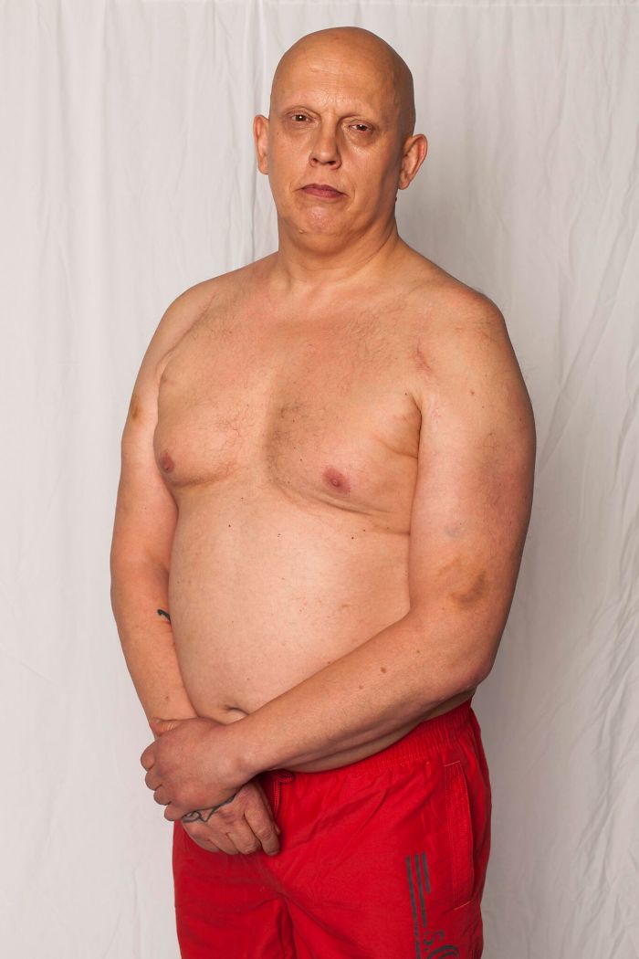 Love Disfigure Swimwear Photo Campaign