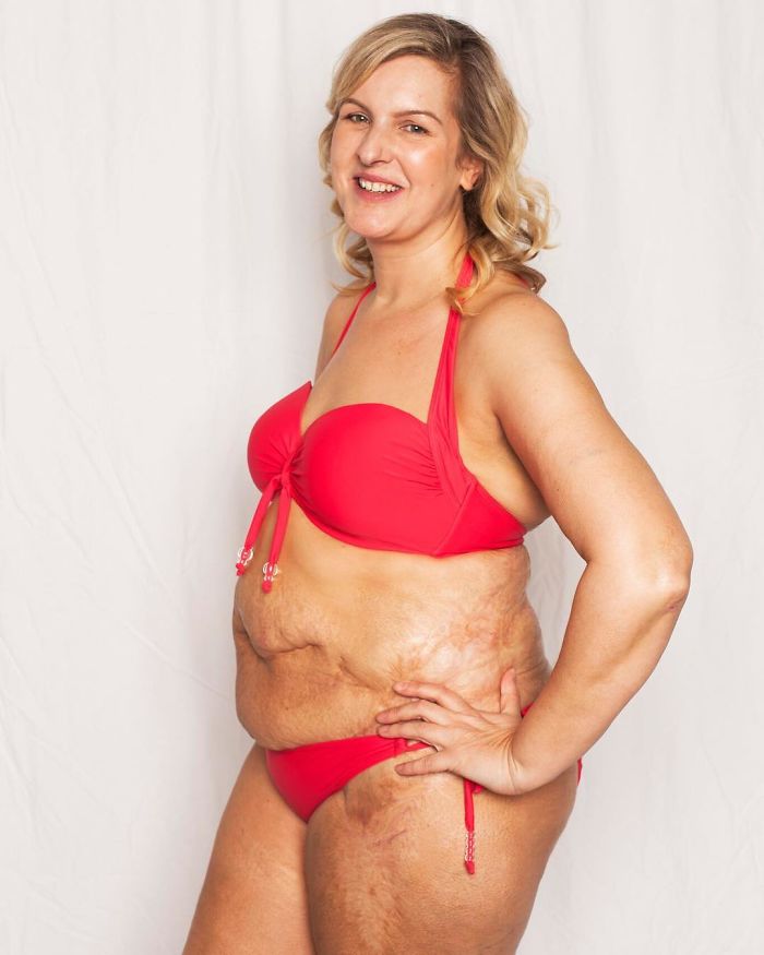 Love Disfigure Swimwear Photo Campaign