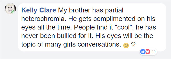 different-eyes-colors-cat-moon-boy-madden-friendship-11