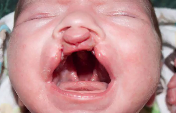 different-eyes-colors-cat-moon-boy-madden-friendship-15